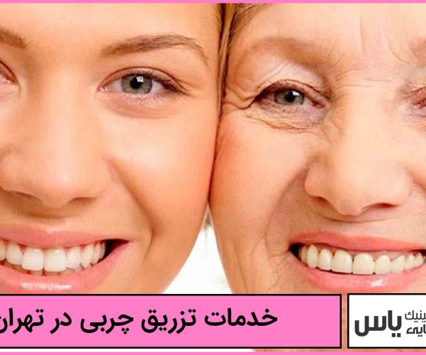 خدمات تزریق چربی در تهران